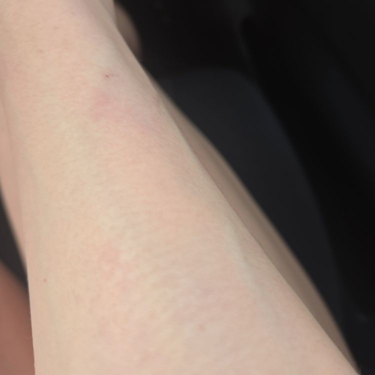 😣😣😣春になると…。