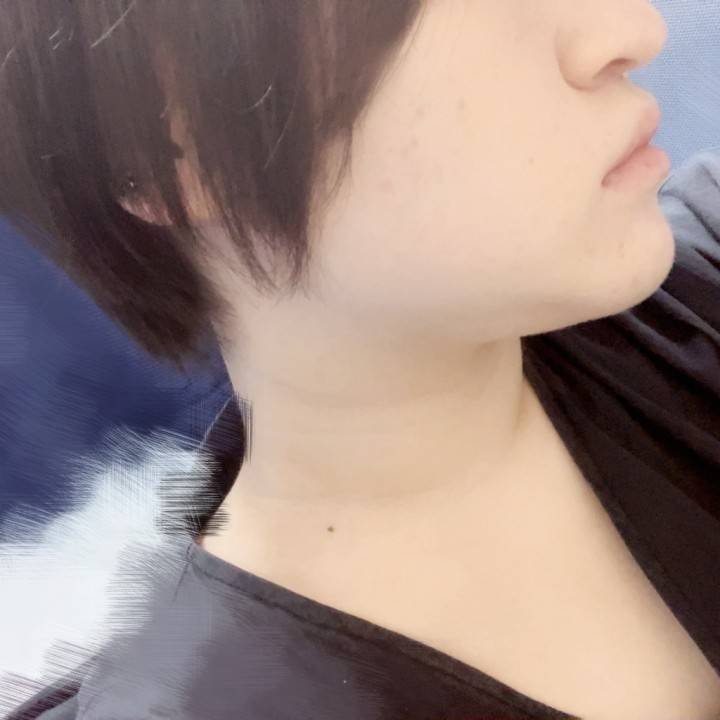 ✂️
