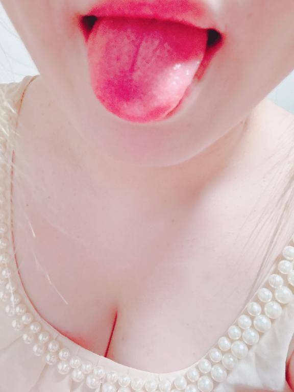 ほっぺに〇〇〇が・・・??