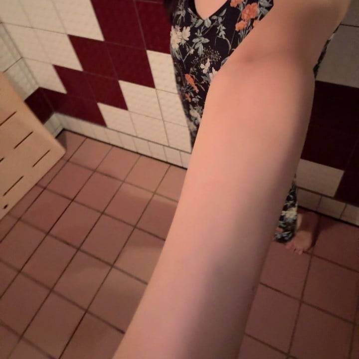 🥺