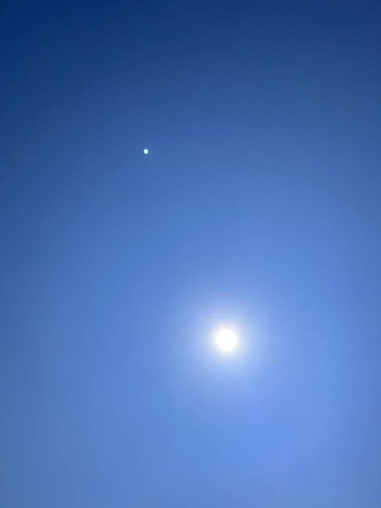 今日の最高気温は34° 晴れが一日中続きそうです☀️