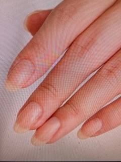 三木先生(コロン美容研究所)