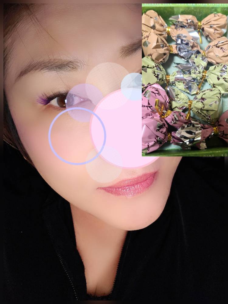 オキニトークから