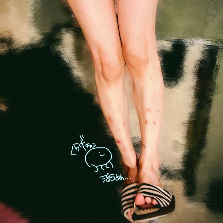 ｱﾙｺｰﾙは毒素