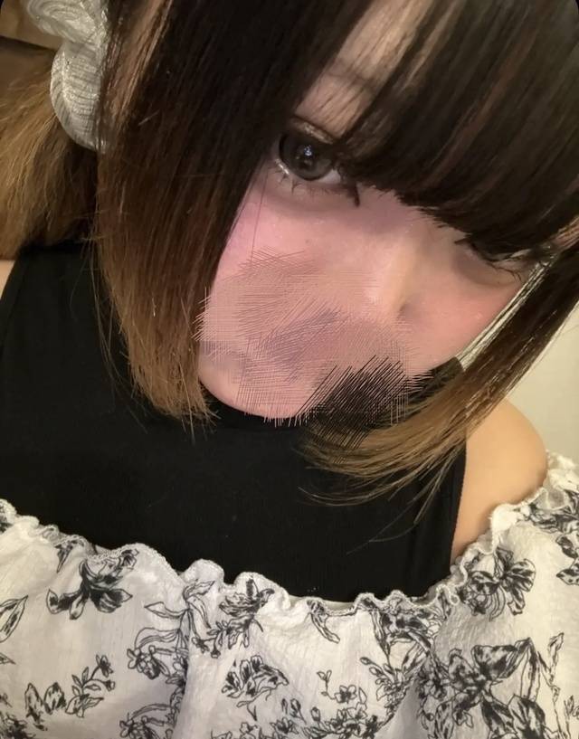 急遽‼️