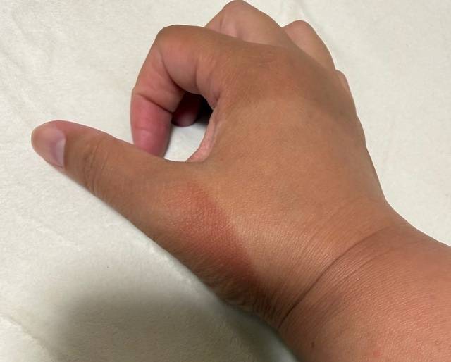 本調子じゃないのに･･･