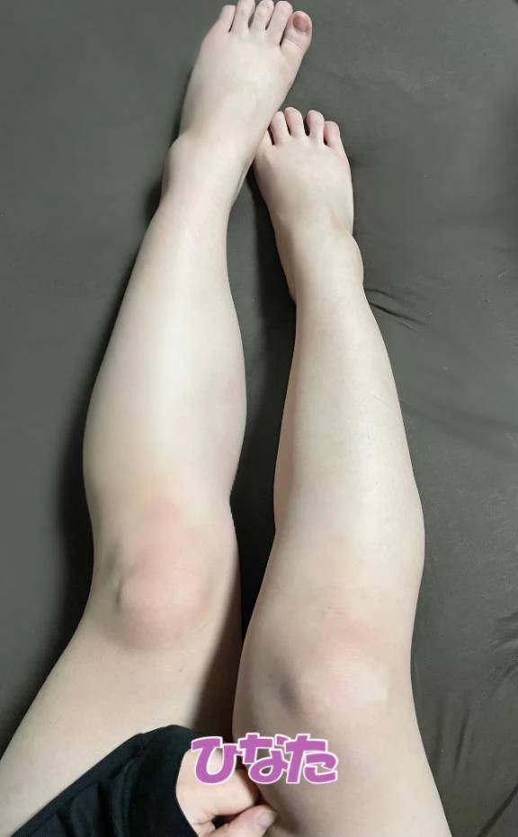 女の子の日になりました😶