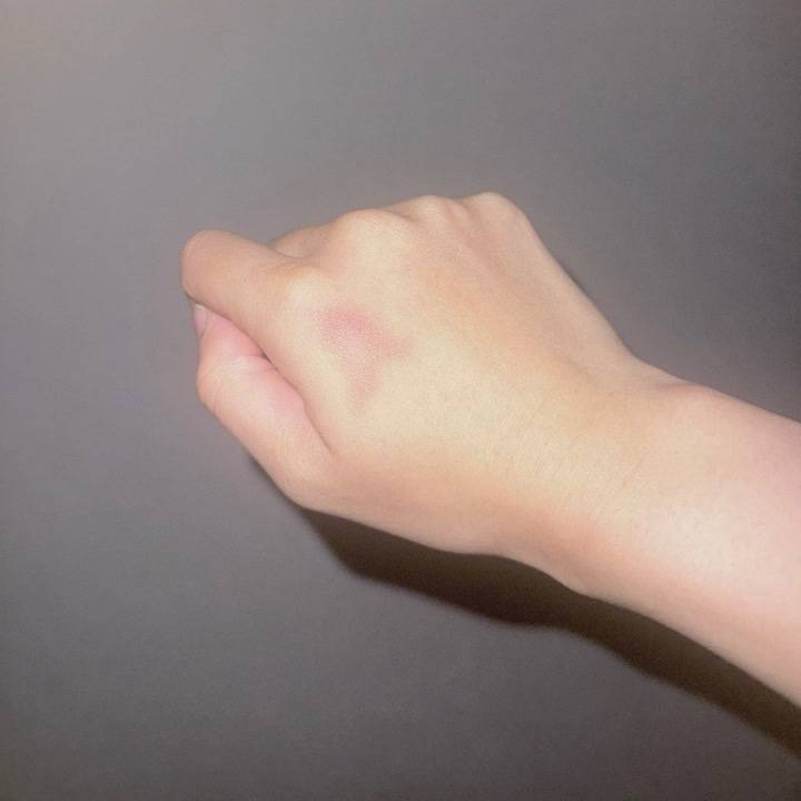 【手にあざできた】