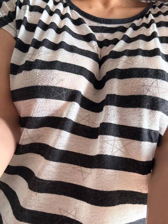 大分良くなりましたー