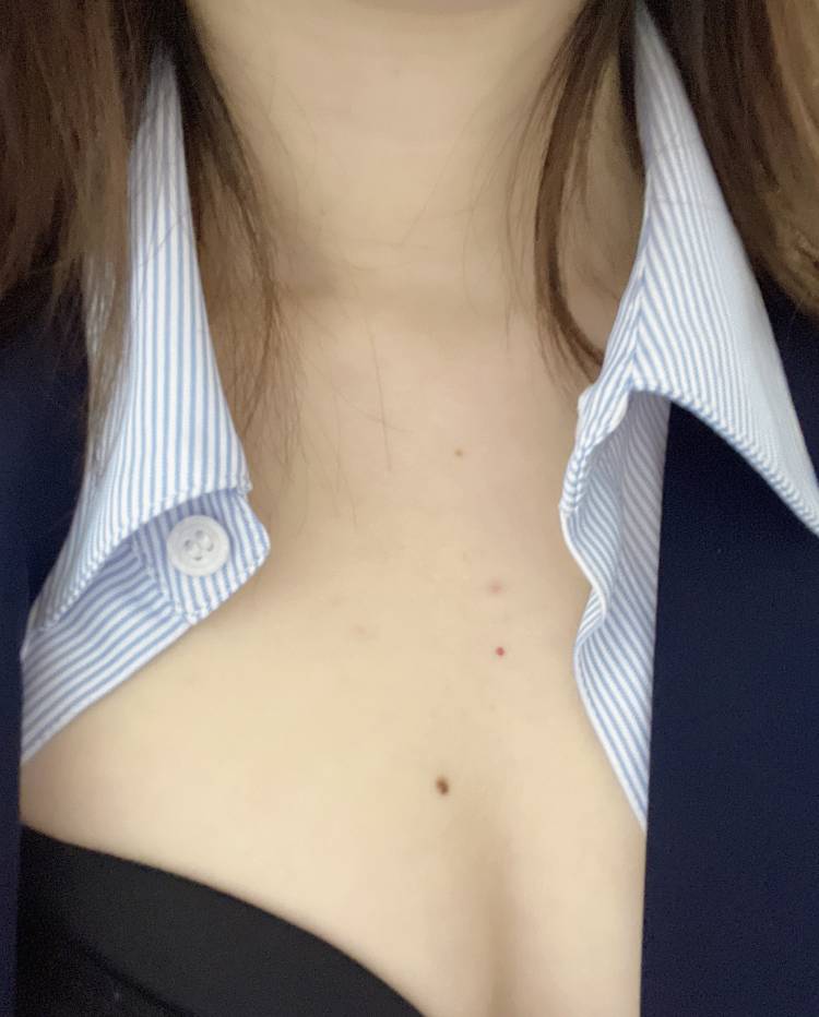 31日目