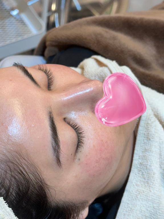 美肌ケア💆‍♀️