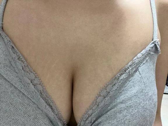 なおった！！！