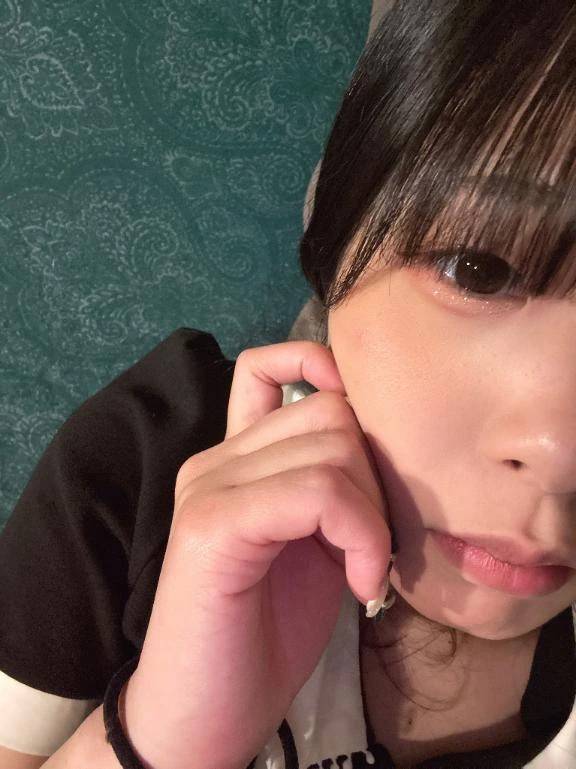にきびできた🥲