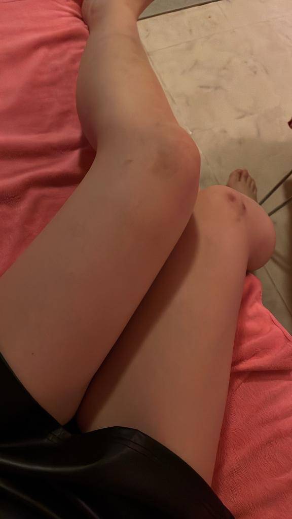 ゆめにもでてくるくらい