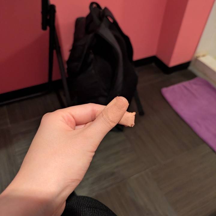 指は何とか治ってきてるよ〜