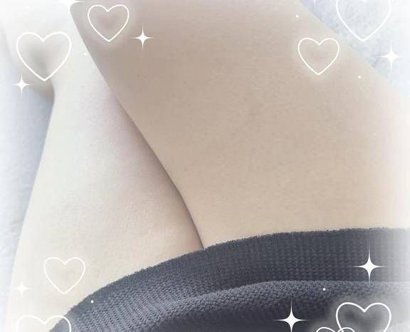 あちち///
