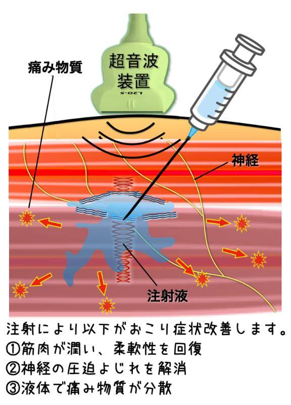 新人 りな(Rina)(高知出張メンズエステ-RELAX)