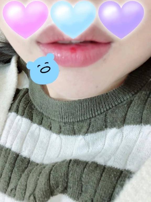 アイタタ(´இωஇ｀)