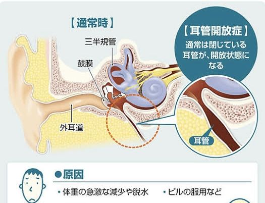 耳壊れました…